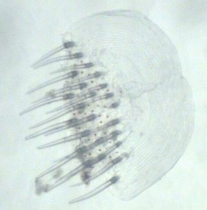 Mit feinen Borsten besetzte Schuppe des Eberfischs, Aufnahme von einem Mikroskop
