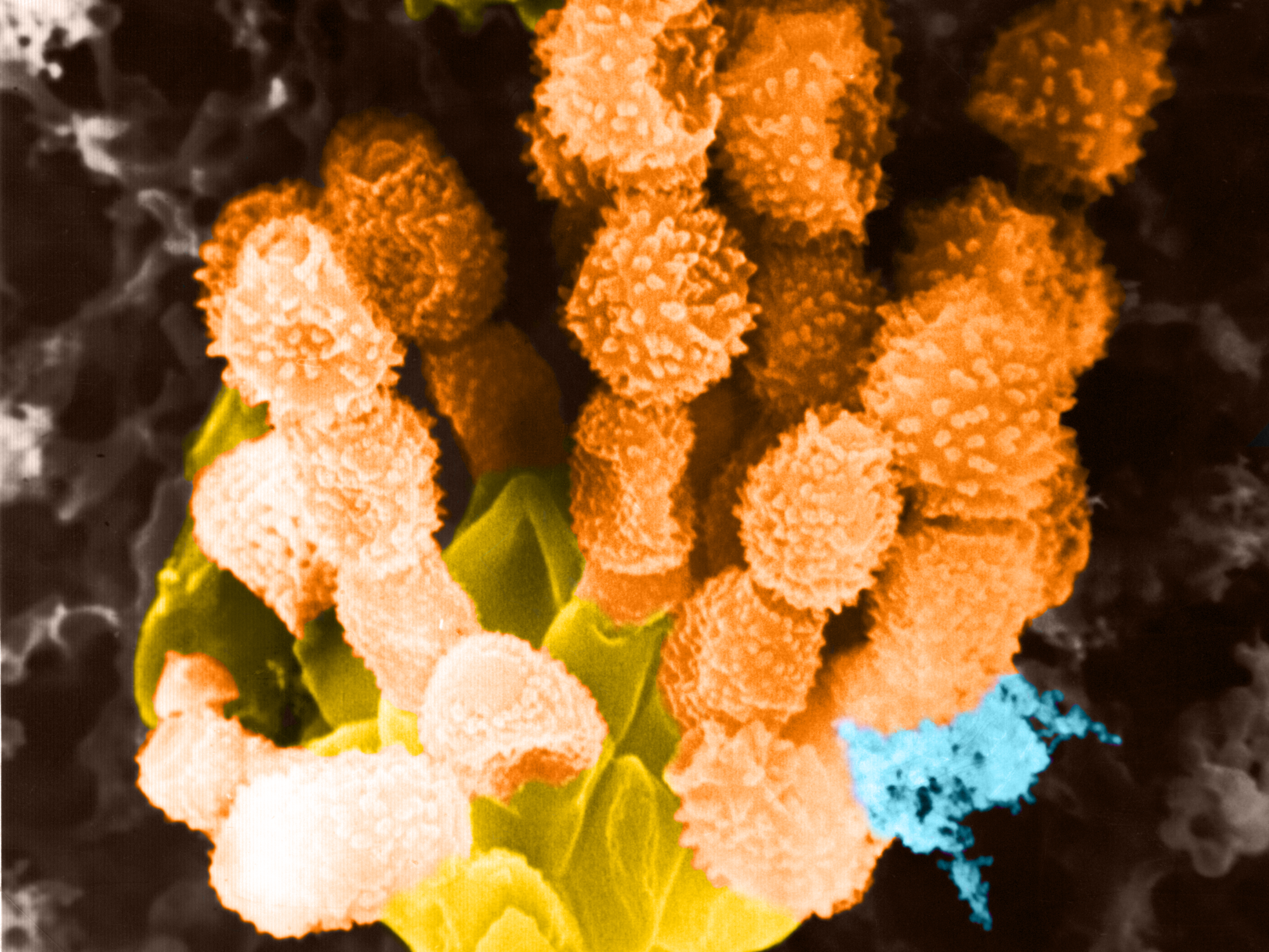 Ein Schimmelpilzes der Gattung Penicillium unter dem Rasterelektronenmikroskop