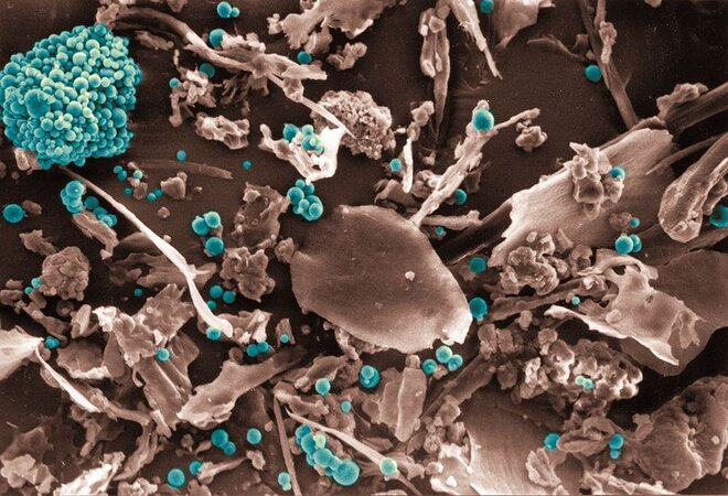 Click to zoom image Colourised scanning electron micrograph (10,000-fold) of a bio-aerosol probe from a chicken house. Distinguishable are bacteria (magenta), feather fragments (orange) and litter, food and feces particles.