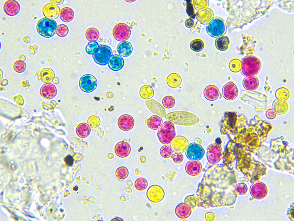Some  mould spores between toner particles