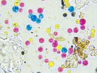 Some mould spores between toner particles Some mould spores between toner particles