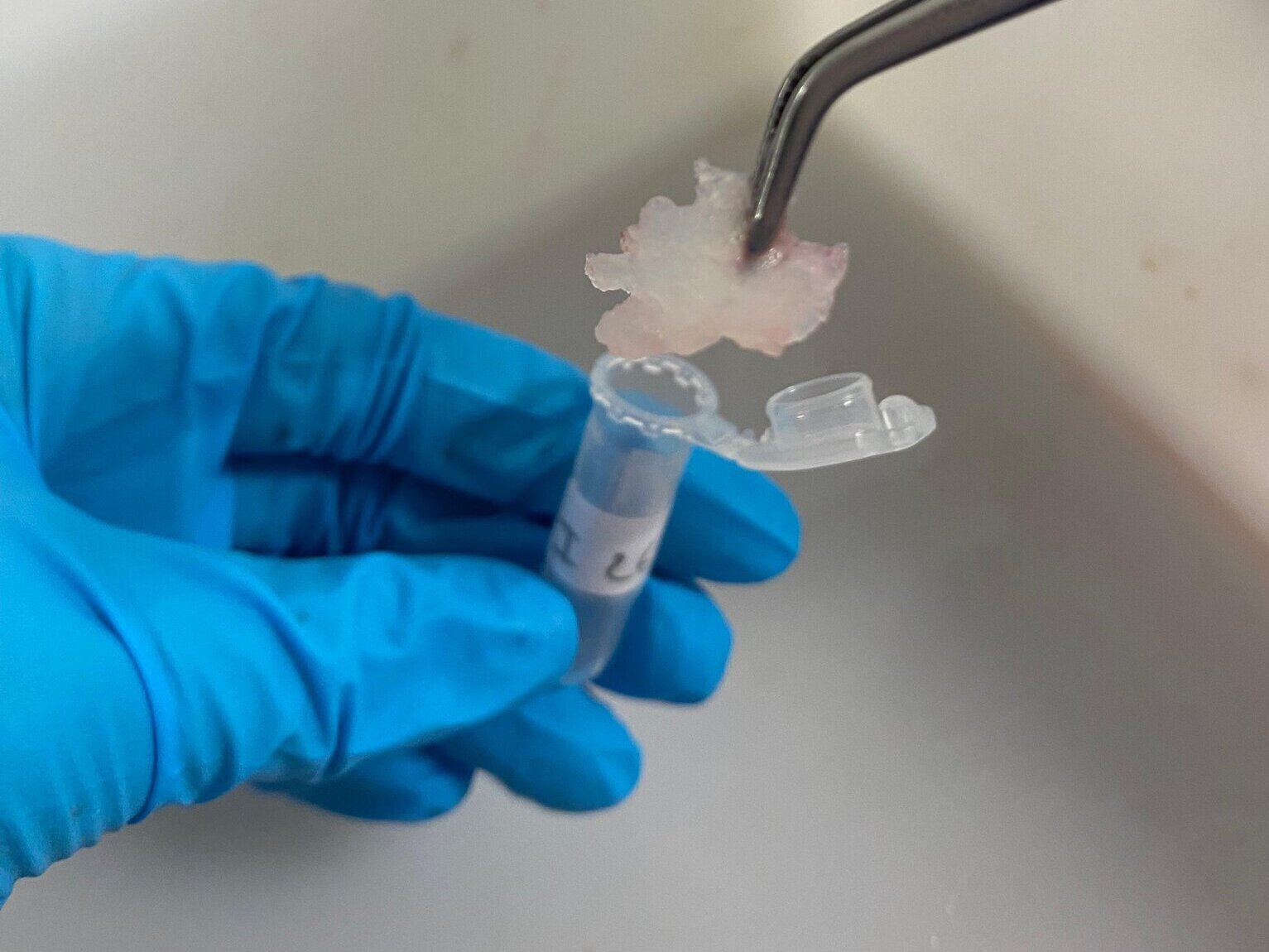 A muscle sample is taken.