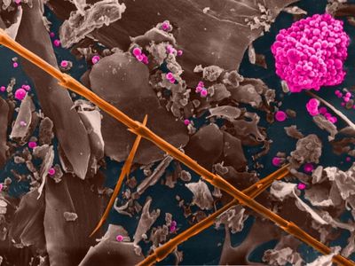 Eine eingefärbte Mikroskopaufnahme von Tierabluft in Ställen