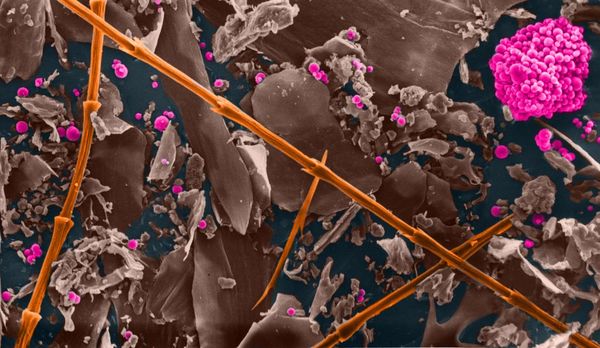 Eine eingefärbte Mikroskopaufnahme von Tierabluft in Ställen