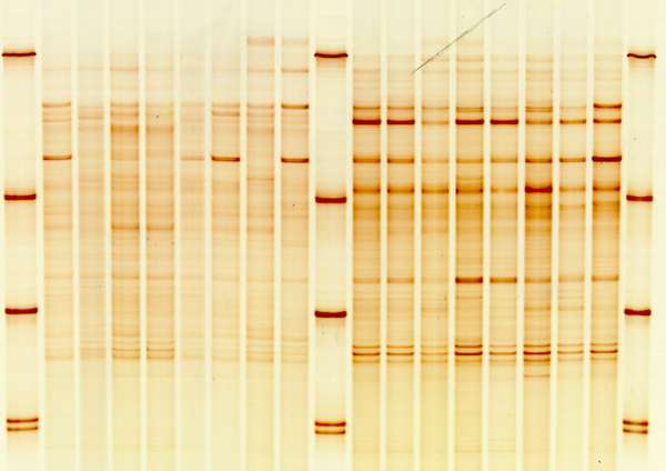 Genetic fingerprints of bacterial communities from soil (here: rhizosphere)