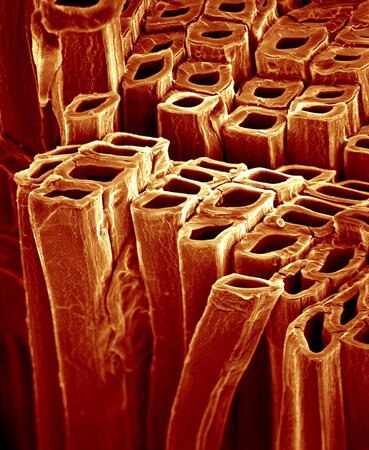 Delignifizierte Holzfasern