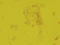 Transmitted light microscopy of a bio-aerosol particle from pig house air Transmitted light microscopy of a bio-aerosol particle from pig house air