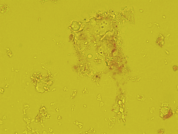 Click to zoom image Transmitted light microscopy of a bio-aerosol particle from pig house air