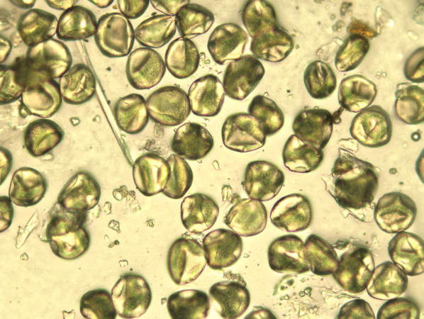 Click to zoom image Hazel pollen