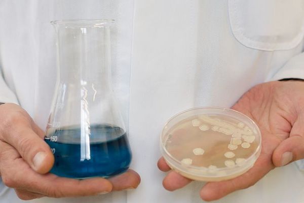Eine Person in einem weißen Kittel hält ein Glasgefäß mit blauer Flüssigkeit und eine Petrischale mit einer Kultur