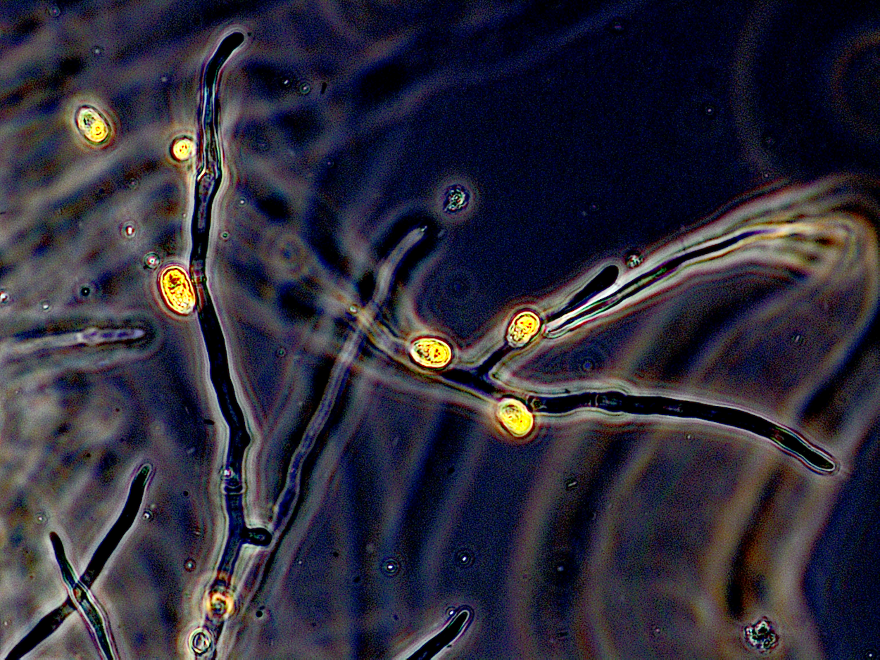 The microalgae attach themselves to the fungus's mycelium.