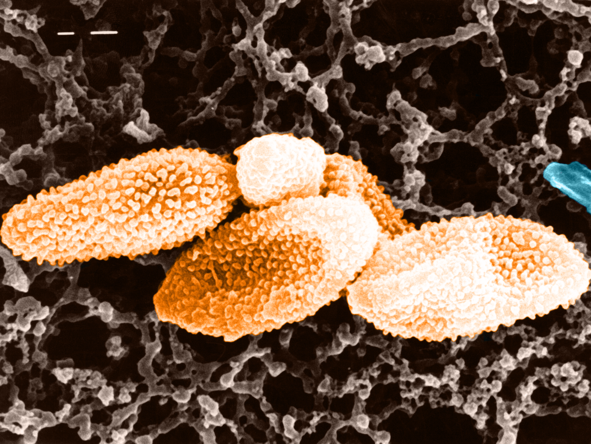Schimmelpilzsporen unter dem Rasterelektronenmikroskop
