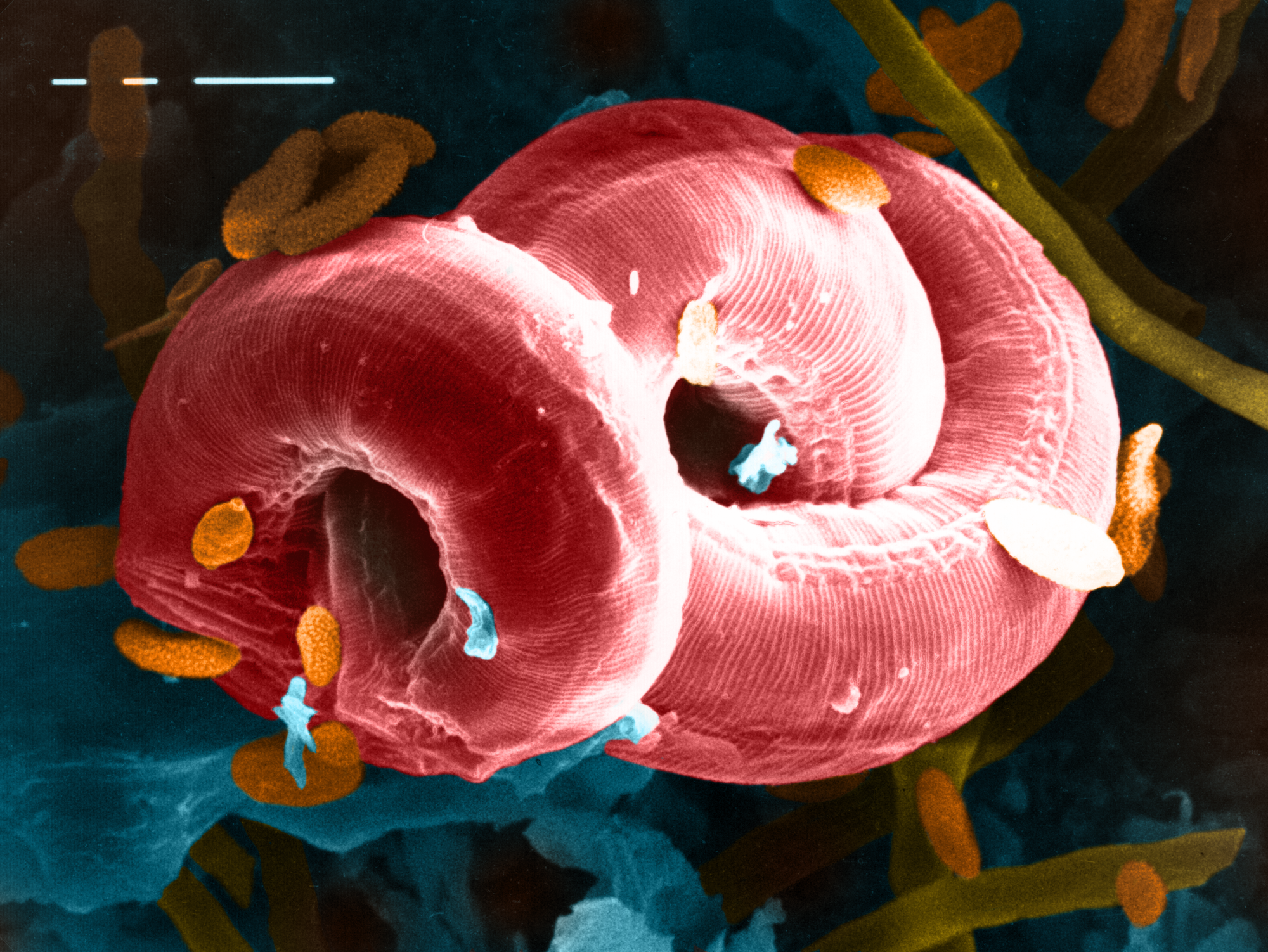 Nematode unter dem Rasterelektronenmikroskop
