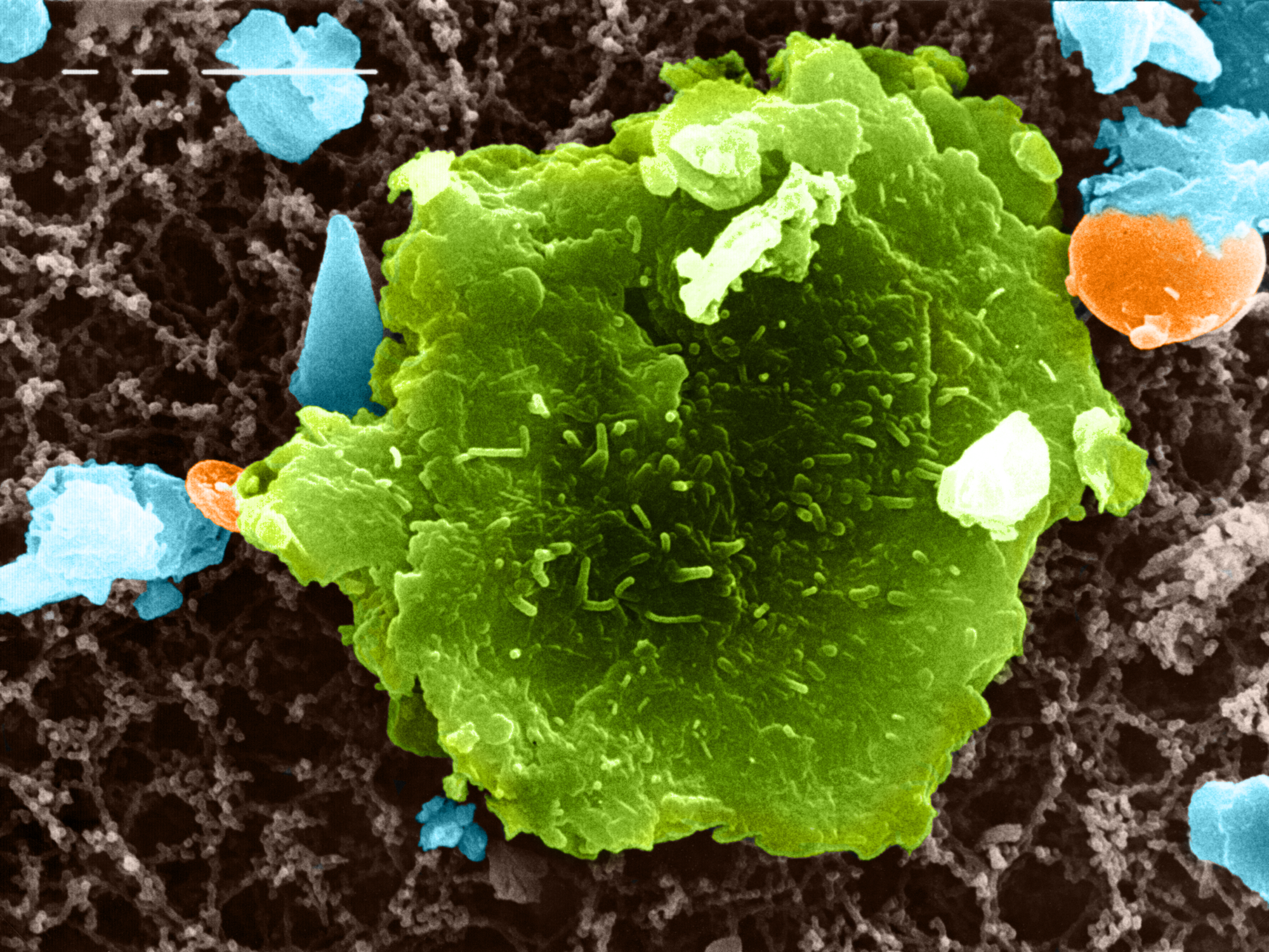 Oberseite eines Blattfragments unter dem Rasterelektronenmikroskop