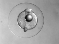 Befruchtetes Fischei mit erkennbarem Embryo.