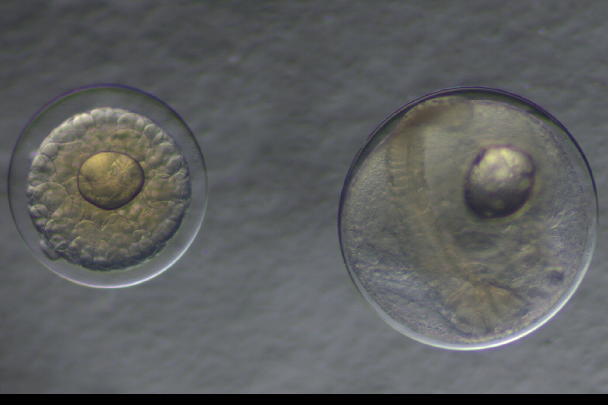 Danach suchen wir: Makrelen- und die kleineren Stöckereier. Mikroskopische Aufnahme von Fischeiern.