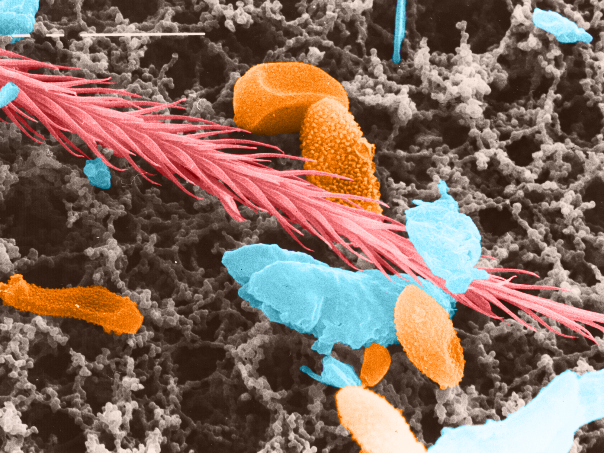 Tasthaar eines Käfers und verschiedene Schimmelpilzsporen unter dem Rasterelektronenmikroskop