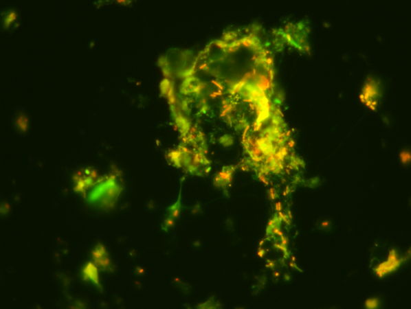Click to zoom image Fluorescence microscopy of a bio-aerosol particle from pig house air