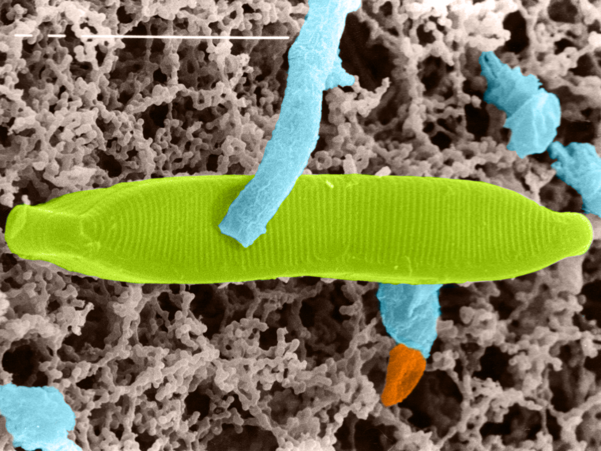 Kieselalge unter dem Rasterelektronenmikroskop