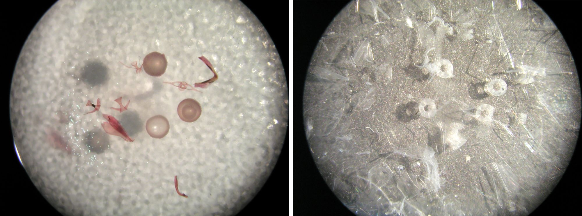 Mikroskopische Aufnahmen aus dem Mageninhalt von Tintenfischen: Grundel-Otolithen, Tintenfischschnabel, Tintenfischlinse (links), Fischwirbel (rechts).